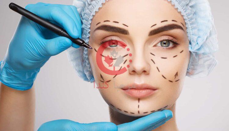 الجراحة التجميلية في كندا