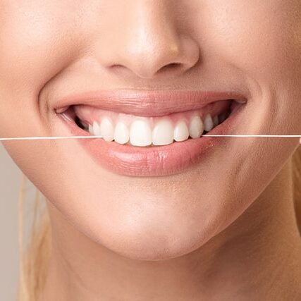 teeth-cleaning-min (1)